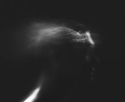 Focus & Brain Fog