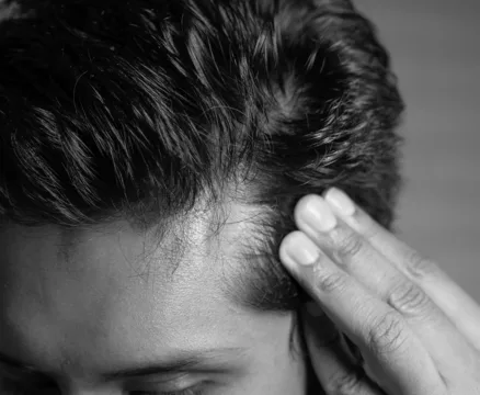 Hair Loss